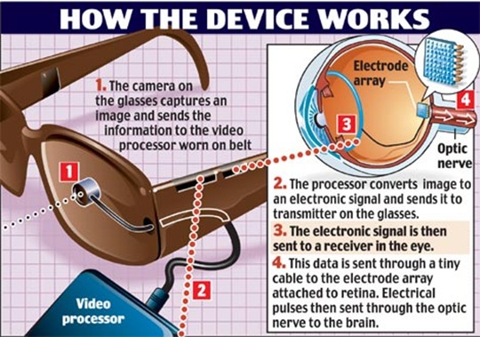 U.S. bionic eye recently tested successfully in Europe | TechCrunch