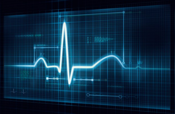 Cardiomatics bags $3.2M for its ECG-reading AI – TechCrunch