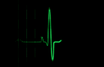 internet heartbeat