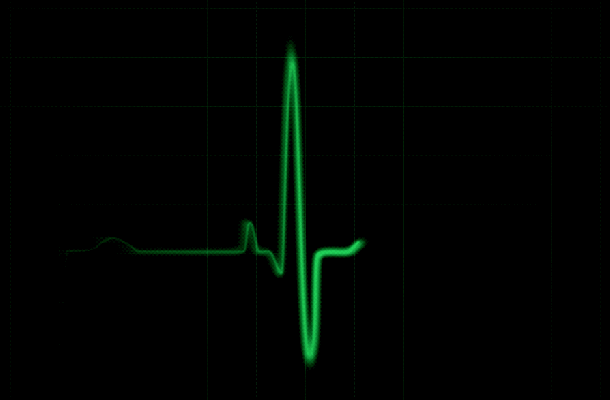Internet heartbeat