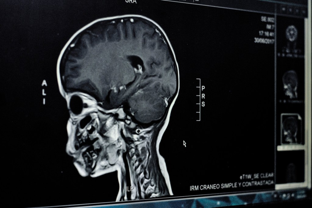 Digital image of the MRI in a children hospital.