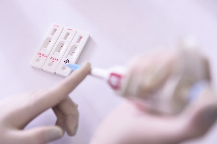 The Technological Vaccine Center of the Federal University of Minas Gerais is Testing a Vaccine against the Coronavirus (COVID – 19) and also Testing Diagnosis Kits