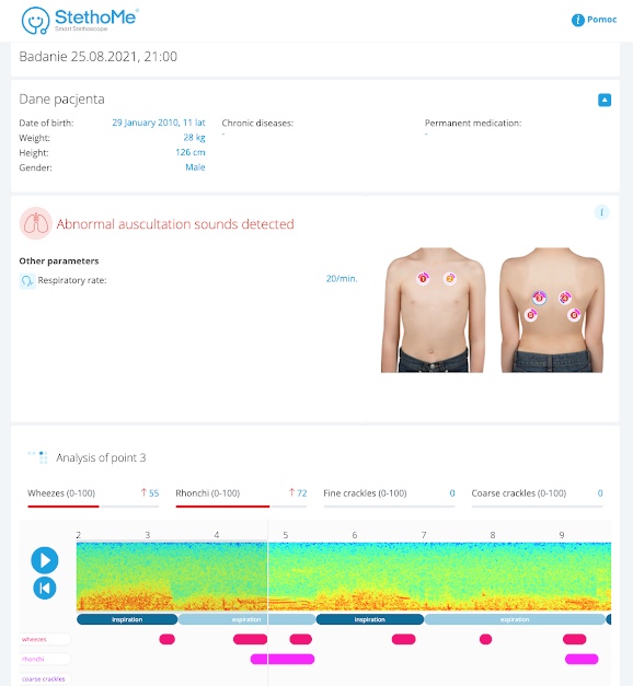 اسکرین شاتی از StethoMe که یک نمای کلی از هر ضبط را نشان می دهد تا پزشکان بتوانند از دور به ریه های کودک گوش دهند