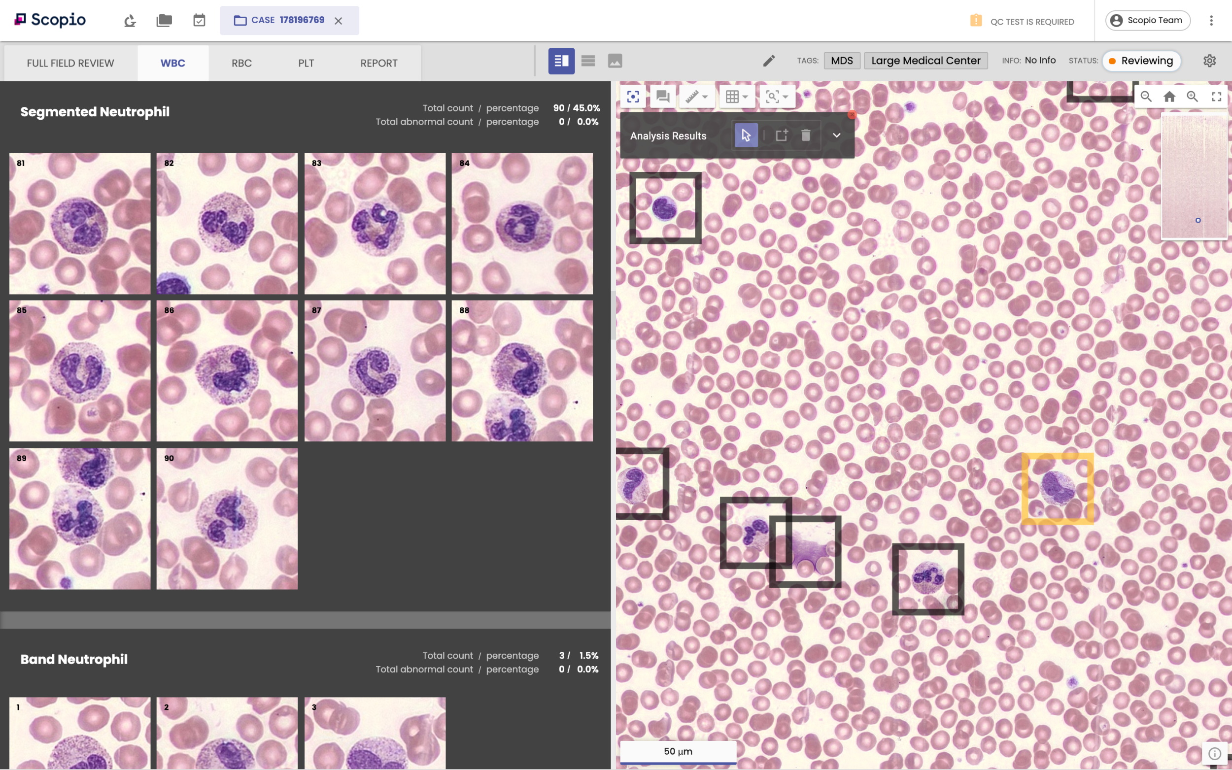 Scopio's blood inspection app shows cells and close-ups.