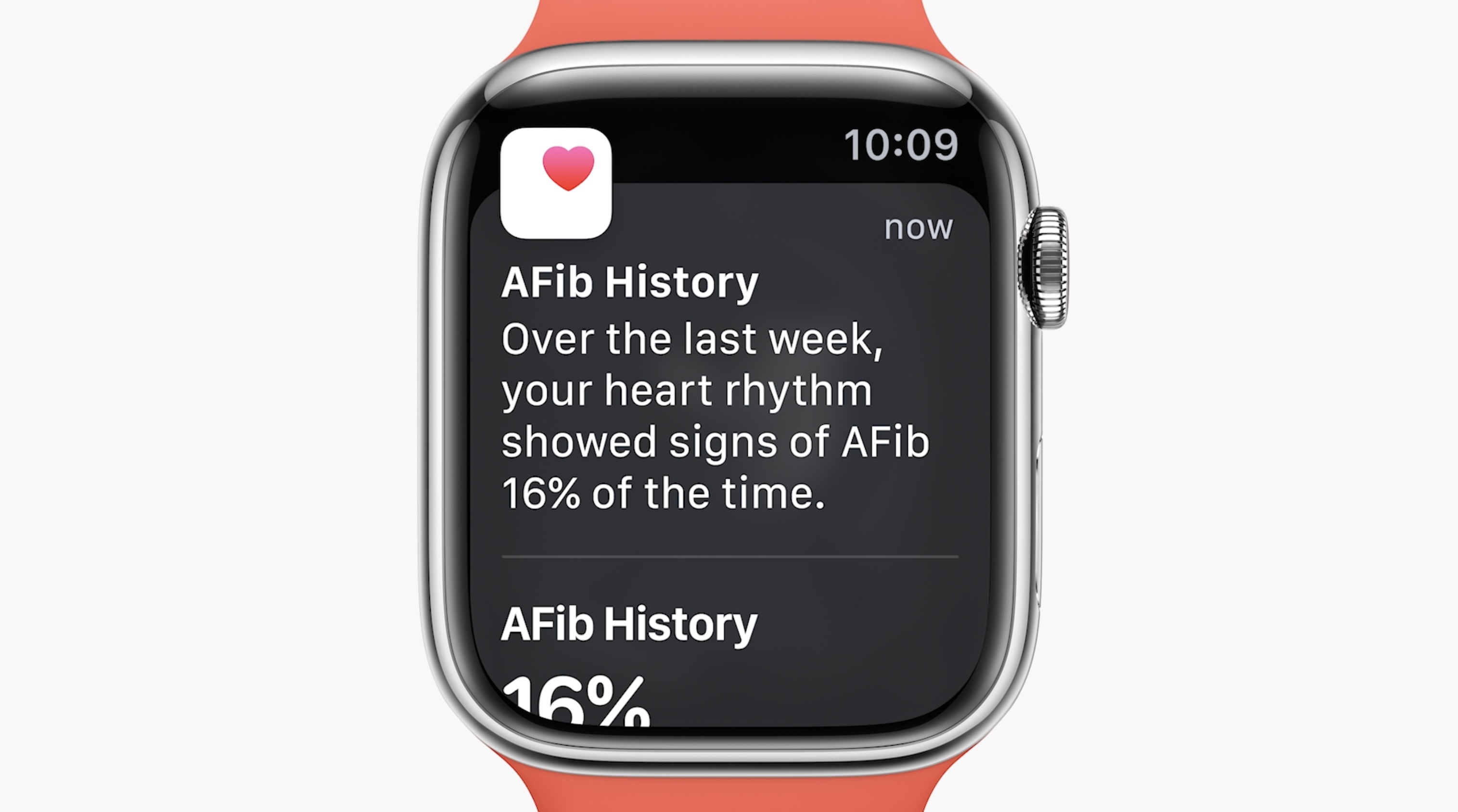 Apple Watch displaying AFib history