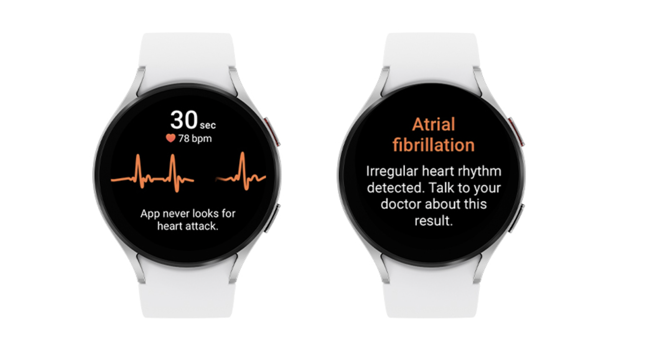 An image of Samsung's irregular heart rhythm feature on a Galaxy watch